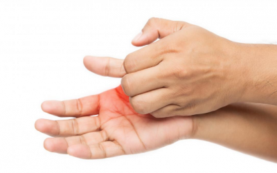 Ngứa lòng bàn tay do đâu?