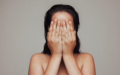 Lưu ý 5 vấn đề về da khi Hè đến