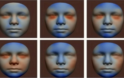 Uống rượu khi đang mang thai, khuôn mặt thai nhi có thể bị thay đổi