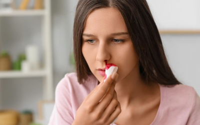 Vì sao chảy máu cam gia tăng vào mùa Hè?