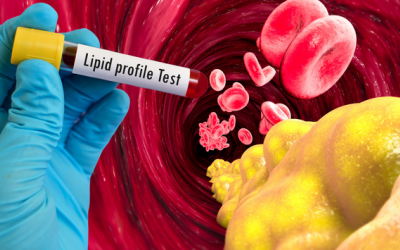 Mỡ máu cao nguy hiểm thế nào và cần điều trị ra sao?