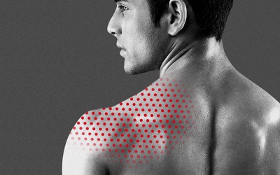 Cách phòng ngừa mụn khi hay bị ra mồ hôi