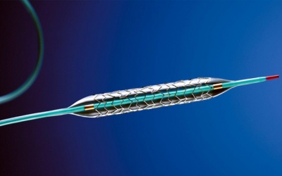 Tắc hẹp mạch vành: Phương pháp đặt stent có những rủi ro nào?