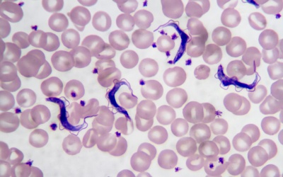 Chagas - 'Căn bệnh thầm lặng' đáng sợ lây lan từ ký sinh trùng 