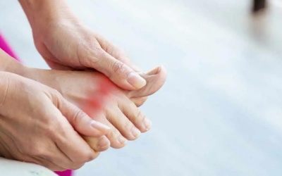 Cách giảm đau do gout tự nhiên tại nhà
