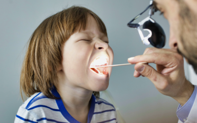 Viêm amidan để lâu có nguy hiểm không? 