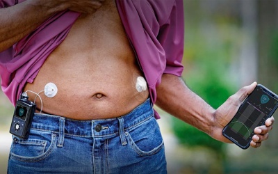 FDA phê duyệt “tụy nhân tạo” bơm insulin tự động cho người bệnh đái tháo đường