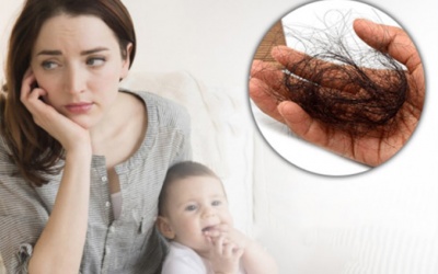 6 cách đối phó với chứng rụng tóc sau sinh