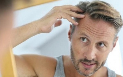 Bỏ túi 8 mẹo chăm sóc da đầu nhờn cho nam giới