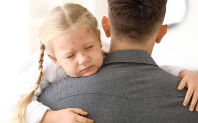 Tôi có thể đi làm nếu con đang bị thủy đậu không?