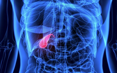 Sỏi mật 17,1mm dùng TPBVSK Kim Đởm Khang được không?