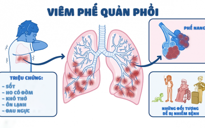 Cảnh giác với biến chứng của bệnh viêm phế quản phổi