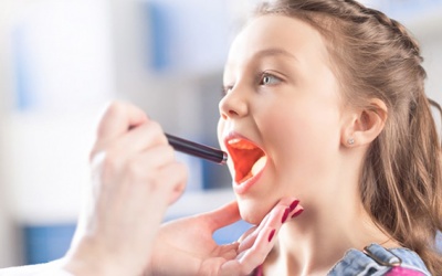 Lưu ý để phòng bệnh viêm amidan ở trẻ em trong mùa Hè