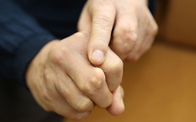 Hạt tophi và bệnh gout: Những điều bạn cần biết