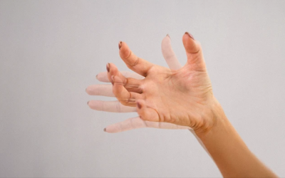 Bị run tay uống calci vẫn không đỡ phải làm sao?