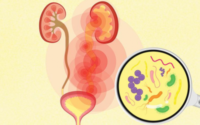 Vì sao nhiễm trùng đường tiết niệu gia tăng trong mùa Hè?