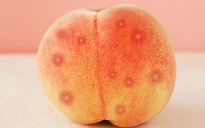 Cách ngăn ngừa và loại bỏ mụn nhọt ở mông tại nhà