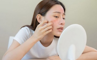 Những lưu ý khi chăm sóc da nhạy cảm trong mùa Hè