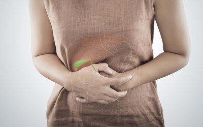 Làm thế nào để giảm đau bụng, khó tiêu do sỏi mật 8,2mm?