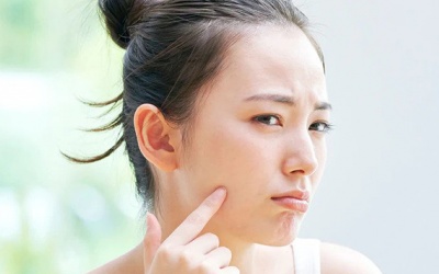 Cách xử lý mụn trứng cá nhanh gọn