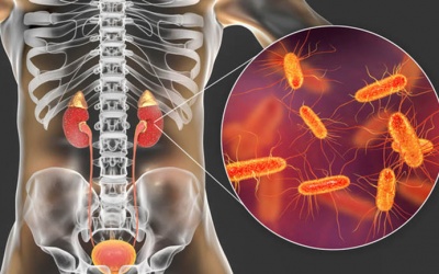 Suýt hỏng thận, suy thận vì tự ý điều trị bằng kháng sinh