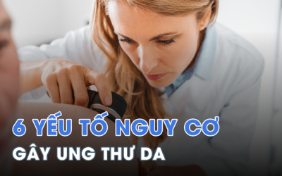 Cảnh giác với 6 yếu tố nguy cơ gây ung thư da