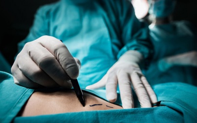 Livestream ca phẫu thuật thẩm mỹ, bác sỹ người Mỹ bị cấm hành nghề