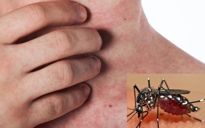 Hiện tượng El Nino có thể làm gia tăng dịch bệnh do muỗi truyền
