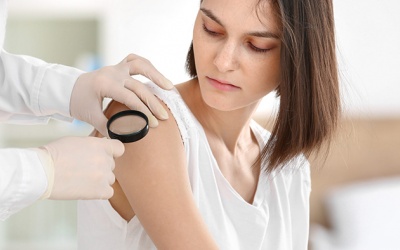 Cách nhận biết và chăm sóc da bị viêm nang lông