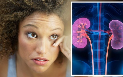 Mù lòa, suy thận do biến chứng mạch máu nhỏ của bệnh đái tháo đường