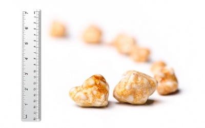 Sỏi tăng từ 10 lên 12mm, có nên cắt túi mật không?