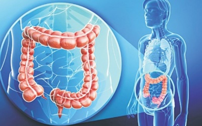 Ung thư đại tràng: Những thông tin bạn cần biết