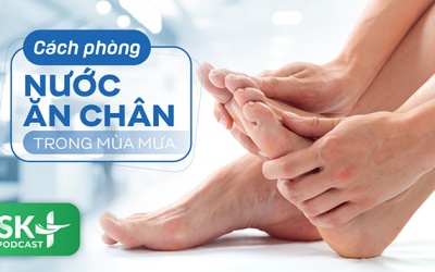 Podcast: Cách phòng nước ăn chân trong mùa mưa