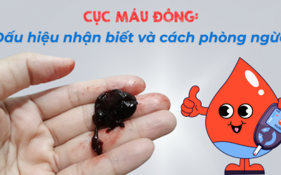 Cục máu đông: Dấu hiệu nhận biết và cách phòng ngừa 