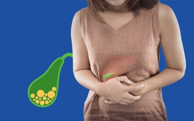 Men gan cao, sỏi túi mật 22mm có nguy hiểm không?