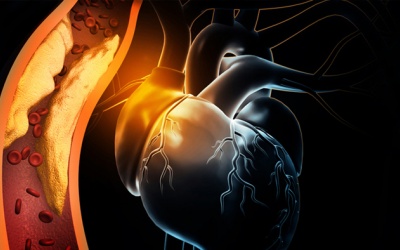 Ngoại tâm thu thất, thiếu máu cơ tim có điều trị khỏi được không?