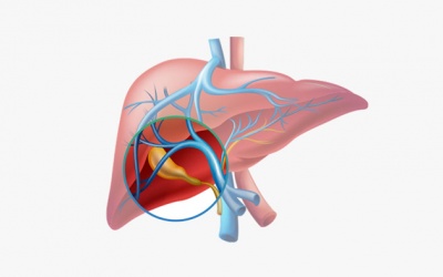 Có phải sỏi mật 11mm kèm mỡ máu cao gây đầy hơi không?