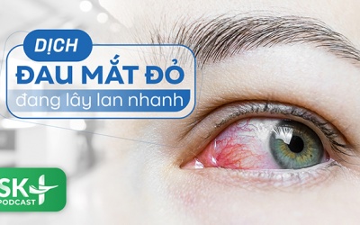 Podcast: Dịch đau mắt đỏ đang lây lan nhanh
