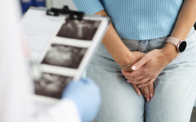 U xơ tử cung được điều trị ra sao?