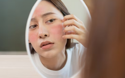 4 điều cần tránh khi chăm sóc da hỗn hợp