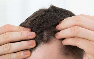 Infographic: Các cách khắc phục tình trạng tóc mỏng và thưa