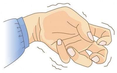 Bị vẹo cổ kèm run tay, dùng TPBVSK Vương Lão Kiện được không?