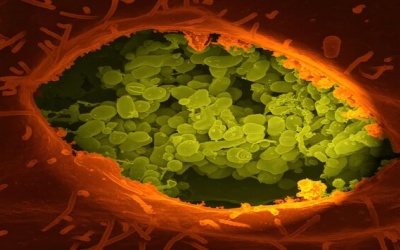 Vi khuẩn đường ruột có vai trò quan trọng trong việc chống lại ung thư đại trực tràng