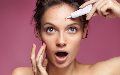 Biện pháp xử lý mụn trên trán hiệu quả 