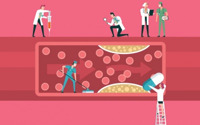 Thiếu máu cơ tim: Khi nào điều trị bằng thuốc, khi nào cần phẫu thuật?