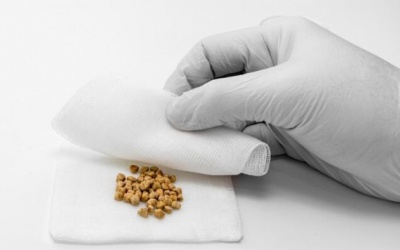 Có viên sỏi mật 1cm có dùng TPBVSK Kim Đởm Khang được không?