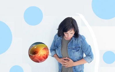 Có sỏi mật 35mm nhưng đang cho con bú có dùng thảo dược được không?