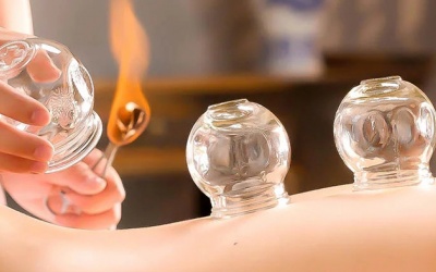 Giác hơi có giúp cải thiện da sần vỏ cam?