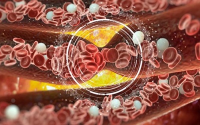 Có dấu hiệu nào cảnh báo hình thành huyết khối sau đặt stent?