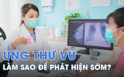 Hướng dẫn 5 bước đơn giản tự khám tầm soát ung thư vú tại nhà